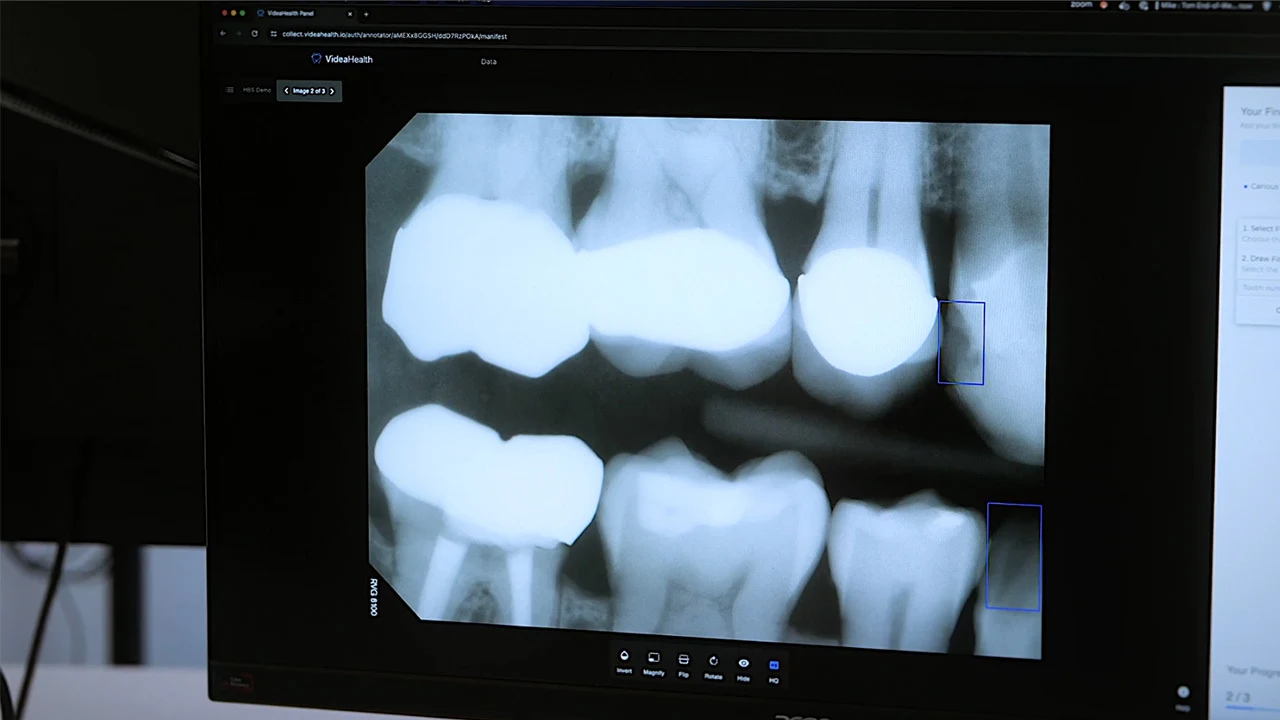 Videahealth Multimedia Case Screenshot